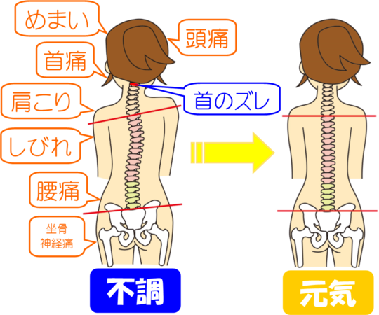 稲毛区で頭痛 首痛なら山田カイロプラクティック